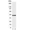 Cyclin Dependent Kinase 6 antibody, R31239, NSJ Bioreagents, Western Blot image 