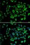 Proteasome 26S Subunit, Non-ATPase 13 antibody, LS-C747583, Lifespan Biosciences, Immunofluorescence image 