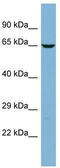 Transmembrane And Coiled-Coil Domain Family 2 antibody, TA344103, Origene, Western Blot image 