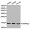 Small Nuclear Ribonucleoprotein D2 Polypeptide antibody, MBS128917, MyBioSource, Western Blot image 