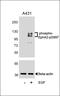 Ephrin type-A receptor 2 antibody, MBS9214716, MyBioSource, Western Blot image 