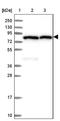 Polycystin 2 Like 2, Transient Receptor Potential Cation Channel antibody, NBP2-47332, Novus Biologicals, Western Blot image 