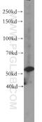 VPS33B Interacting Protein, Apical-Basolateral Polarity Regulator, Spe-39 Homolog antibody, 20771-1-AP, Proteintech Group, Western Blot image 