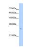 Rhomboid Like 2 antibody, NBP1-59971, Novus Biologicals, Western Blot image 
