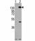 Platelet Derived Growth Factor Receptor Alpha antibody, F50657-0.4ML, NSJ Bioreagents, Western Blot image 