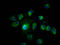Late Endosomal/Lysosomal Adaptor, MAPK And MTOR Activator 1 antibody, LS-C682300, Lifespan Biosciences, Immunofluorescence image 