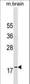 GABA Type A Receptor-Associated Protein antibody, LS-C159695, Lifespan Biosciences, Western Blot image 