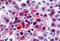 Bombesin Receptor Subtype 3 antibody, NBP1-02374, Novus Biologicals, Immunohistochemistry paraffin image 