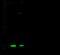 NME/NM23 Nucleoside Diphosphate Kinase 1 antibody, GTX02378, GeneTex, Western Blot image 