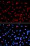 Serine And Arginine Rich Splicing Factor 1 antibody, LS-C331609, Lifespan Biosciences, Immunofluorescence image 
