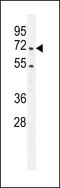 Coactivator Associated Arginine Methyltransferase 1 antibody, LS-C162163, Lifespan Biosciences, Western Blot image 