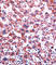 Cytochrome P450 2C9 antibody, abx033736, Abbexa, Western Blot image 