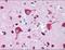 Zinc Finger E-Box Binding Homeobox 2 antibody, NBP1-77179, Novus Biologicals, Immunohistochemistry frozen image 