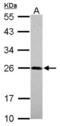 Nerve Growth Factor antibody, NBP2-19536, Novus Biologicals, Western Blot image 