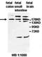 Gamma-Glutamylamine Cyclotransferase antibody, orb77454, Biorbyt, Western Blot image 