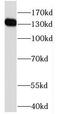 HPS5 Biogenesis Of Lysosomal Organelles Complex 2 Subunit 2 antibody, FNab04001, FineTest, Western Blot image 