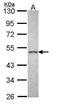 Corticotropin Releasing Hormone Receptor 2 antibody, GTX108177, GeneTex, Western Blot image 