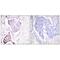 Ubiquitin A-52 Residue Ribosomal Protein Fusion Product 1 antibody, PA5-49755, Invitrogen Antibodies, Immunohistochemistry paraffin image 
