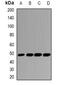 Gasdermin B antibody, abx141990, Abbexa, Western Blot image 