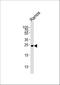 Growth Factor Receptor Bound Protein 2 antibody, A00351, Boster Biological Technology, Western Blot image 