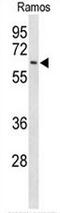 Eukaryotic Translation Initiation Factor 2A antibody, AP51390PU-N, Origene, Western Blot image 