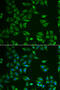 ST3 Beta-Galactoside Alpha-2,3-Sialyltransferase 4 antibody, 22-118, ProSci, Immunofluorescence image 