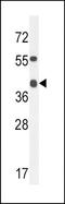 Alcohol Dehydrogenase 4 (Class II), Pi Polypeptide antibody, TA324357, Origene, Western Blot image 