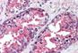 Valosin Containing Protein antibody, NBP1-39850, Novus Biologicals, Immunohistochemistry frozen image 