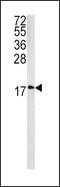 Caveolin 3 antibody, MBS9202711, MyBioSource, Western Blot image 