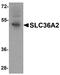 Solute Carrier Family 36 Member 2 antibody, A09777, Boster Biological Technology, Western Blot image 