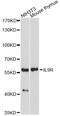 Interleukin 9 Receptor antibody, A6630, ABclonal Technology, Western Blot image 