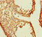 Transmembrane Protein 213 antibody, LS-C396681, Lifespan Biosciences, Immunohistochemistry paraffin image 