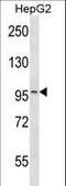 Mitogen-Activated Protein Kinase Kinase Kinase Kinase 3 antibody, LS-B9106, Lifespan Biosciences, Western Blot image 