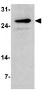 Transmembrane And Immunoglobulin Domain Containing 2 antibody, GTX32127, GeneTex, Western Blot image 