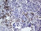 CD79b Molecule antibody, LS-C800095, Lifespan Biosciences, Immunohistochemistry paraffin image 