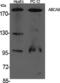 ATP Binding Cassette Subfamily A Member 8 antibody, PA5-50902, Invitrogen Antibodies, Western Blot image 