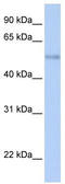 Zinc Finger And SCAN Domain Containing 32 antibody, TA339499, Origene, Western Blot image 