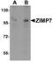 Zinc Finger MIZ-Type Containing 2 antibody, A09987, Boster Biological Technology, Western Blot image 