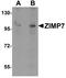 Zinc finger MIZ domain-containing protein 2 antibody, A09987, Boster Biological Technology, Western Blot image 