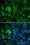 RAK antibody, PA5-76901, Invitrogen Antibodies, Immunofluorescence image 