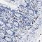 Cerberus 1, DAN Family BMP Antagonist antibody, HPA019917, Atlas Antibodies, Immunohistochemistry paraffin image 