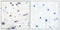 Protein Tyrosine Phosphatase Non-Receptor Type 11 antibody, A00150Y580, Boster Biological Technology, Immunohistochemistry paraffin image 