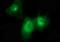 Platelet Derived Growth Factor Receptor Beta antibody, NBP2-46361, Novus Biologicals, Immunofluorescence image 