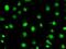 Serine/Threonine Kinase 39 antibody, NBP1-48021, Novus Biologicals, Immunofluorescence image 