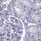 Steroidogenic Acute Regulatory Protein antibody, PA5-55581, Invitrogen Antibodies, Immunohistochemistry paraffin image 