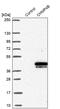 Charged Multivesicular Body Protein 4B antibody, PA5-59552, Invitrogen Antibodies, Western Blot image 