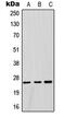 Glutathione S-Transferase Mu 1 antibody, MBS821520, MyBioSource, Western Blot image 