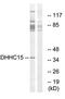 Death Associated Protein Kinase 3 antibody, orb160717, Biorbyt, Western Blot image 