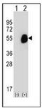 Glutaryl-CoA Dehydrogenase antibody, AP51799PU-N, Origene, Western Blot image 