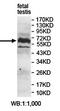 Growth Factor Receptor Bound Protein 14 antibody, orb78276, Biorbyt, Western Blot image 